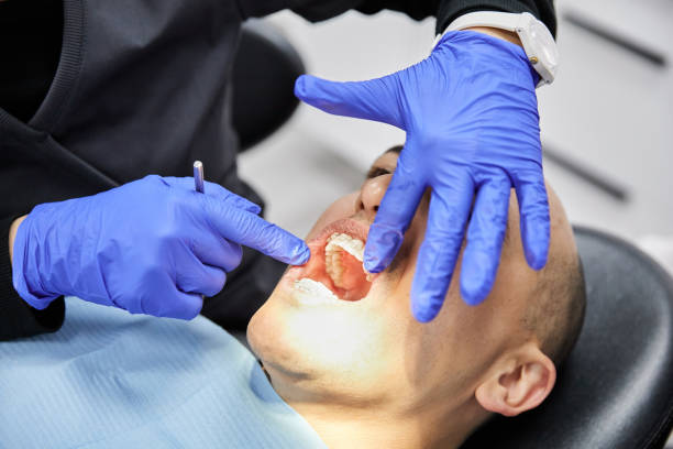Best Emergency Root Canal Treatment in Girard, IL